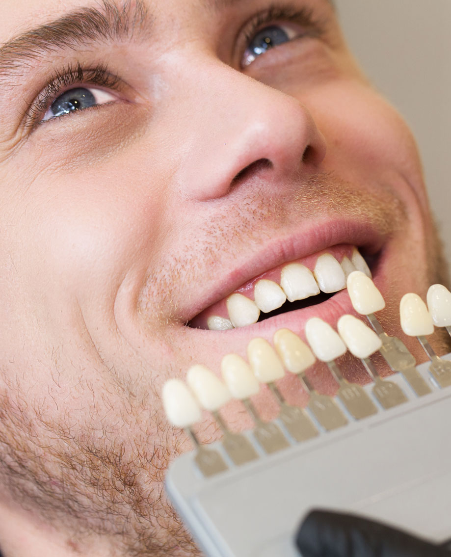 Teeth Whitening